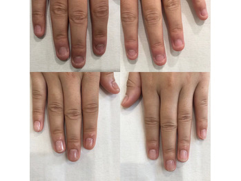 深爪 噛み癖 ちび爪 人気の自爪育成コース 爪の形が気になる方にも Billboard Place 新潟ファッションビル万代ビルボードプレイス 深爪 噛み癖 ちび爪 人気の自爪育成コース 爪の形が気になる方にも Billboard Place 新潟ファッションビル万代ビルボードプレイス