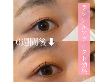 驚くほどまつ毛が伸びる 大人気 ラッシュアディクト まつ毛育毛美容液 Billboard Place 新潟ファッションビル万代ビルボードプレイス 驚くほどまつ毛が伸びる 大人気 ラッシュアディクト まつ毛育毛美容液 Billboard Place 新潟ファッションビル万代ビルボードプレイス