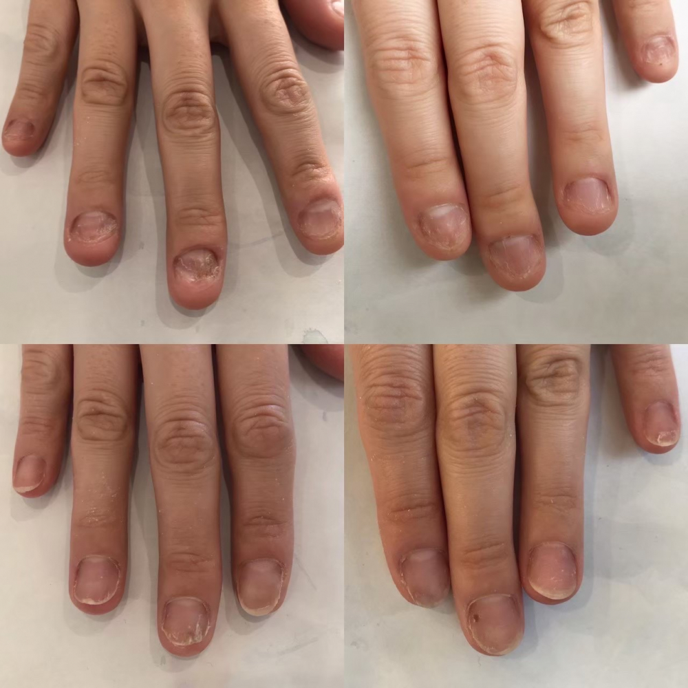 深爪 噛み癖 ちび爪 人気の自爪育成コース 爪の形が気になる方にも Billboard Place 新潟ファッションビル万代ビルボードプレイス 深爪 噛み癖 ちび爪 人気の自爪育成コース 爪の形が気になる方にも Billboard Place 新潟ファッションビル万代ビルボードプレイス