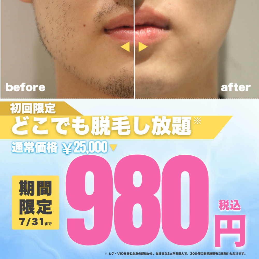 【夏本番】肌見せの季節、ムダ毛ケアはお済みですか?メンズ脱毛サロン「メンズクリア」初回体験980円!